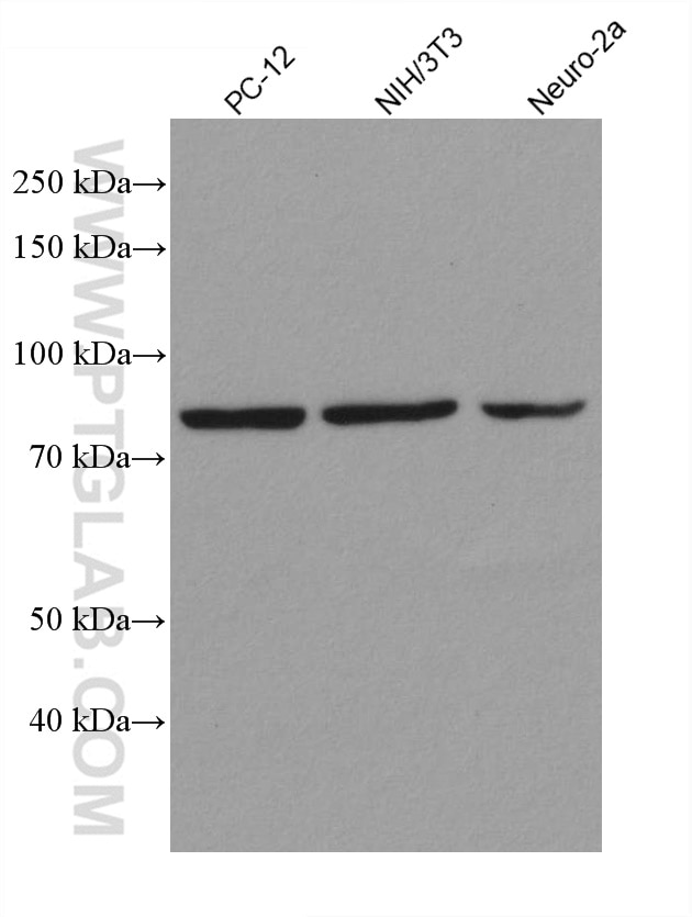 Western Blot (WB) analysis of various lysates using STAT3 Recombinant antibody (80149-1-RR)