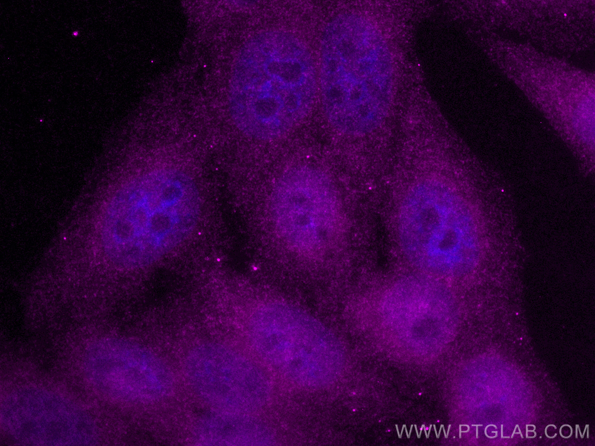 Immunofluorescence (IF) / fluorescent staining of HepG2 cells using CoraLite® Plus 647-conjugated STAT3 Monoclonal ant (CL647-60199)