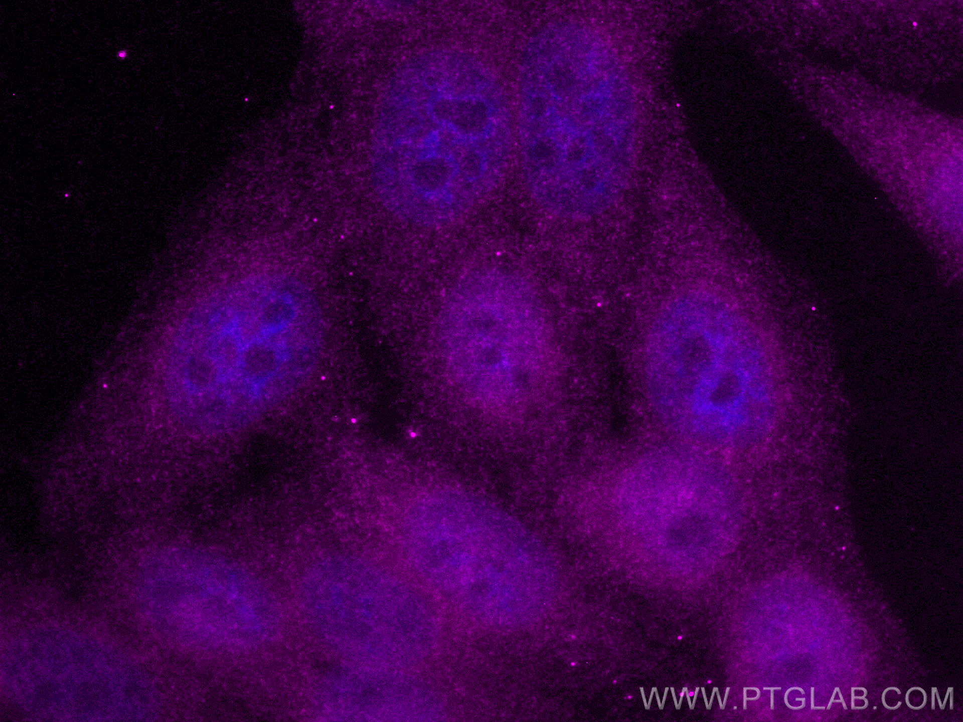 IF Staining of HepG2 using CL647-60199