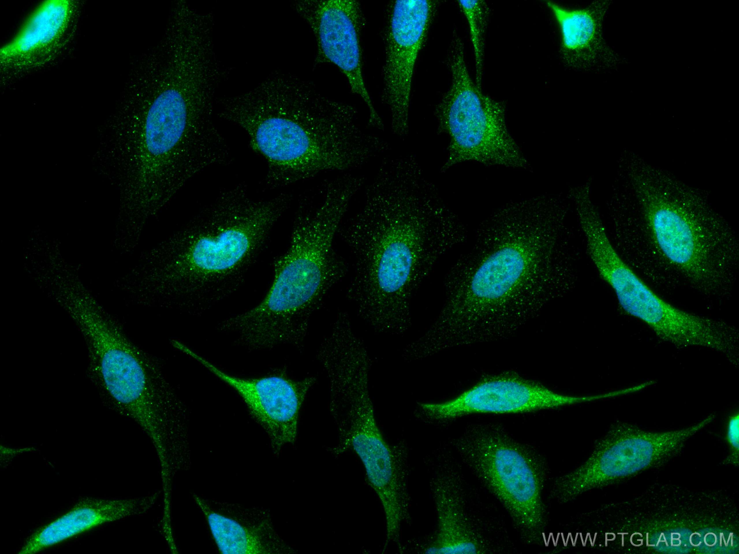 Immunofluorescence (IF) / fluorescent staining of HeLa cells using STAT4 Polyclonal antibody (13028-1-AP)