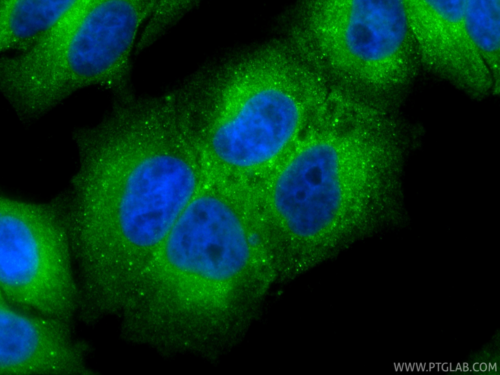 Immunofluorescence (IF) / fluorescent staining of HepG2 cells using STAT4 Polyclonal antibody (13028-1-AP)