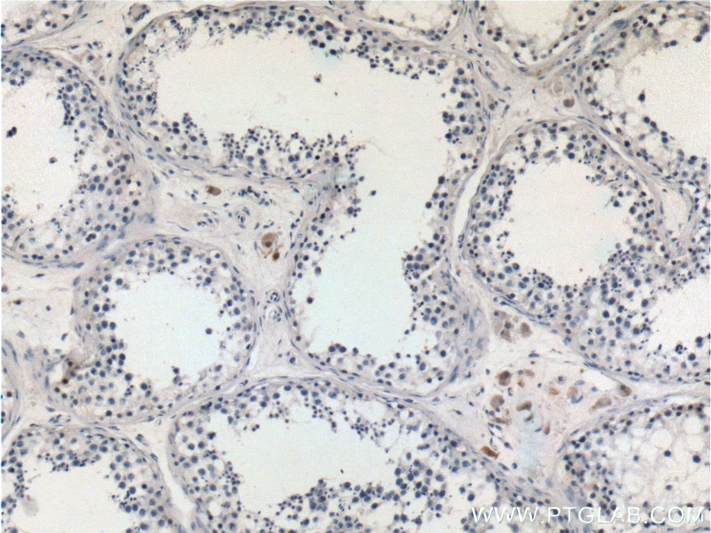 Immunohistochemistry (IHC) staining of human testis tissue using STAT4 Polyclonal antibody (13028-1-AP)