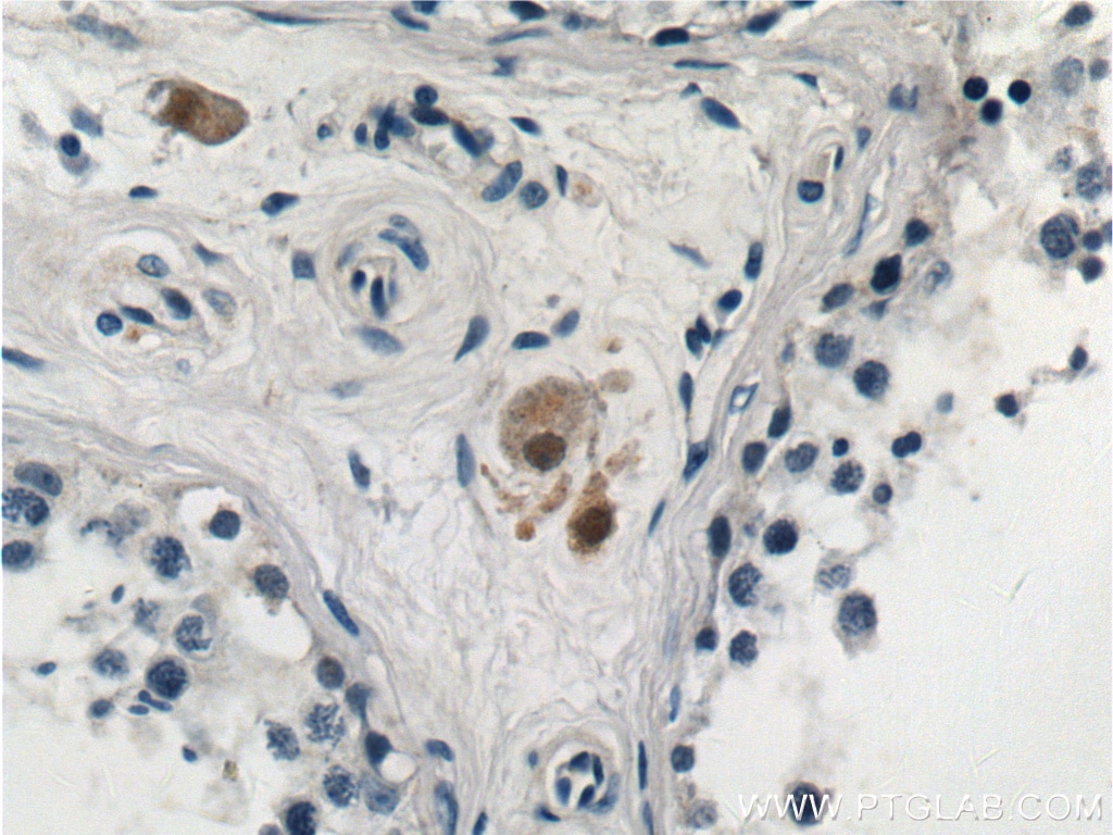 Immunohistochemistry (IHC) staining of human testis tissue using STAT4 Polyclonal antibody (13028-1-AP)