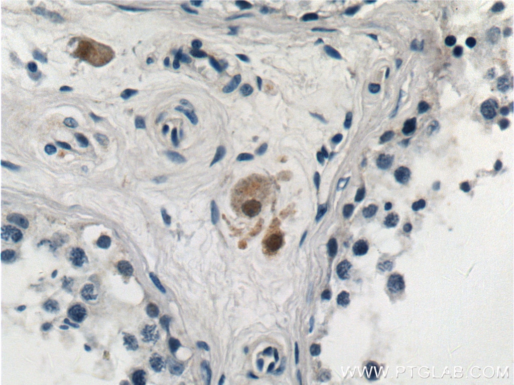 IHC staining of human testis using 13028-1-AP