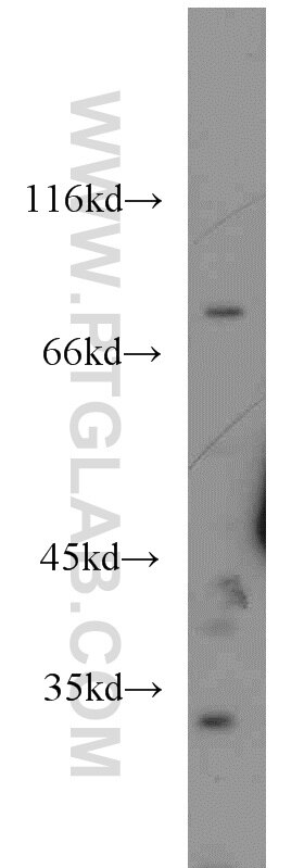 Western Blot (WB) analysis of Jurkat cells using STAT4 Polyclonal antibody (13028-1-AP)