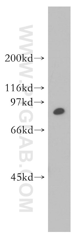 Western Blot (WB) analysis of HeLa cells using STAT4 Polyclonal antibody (13028-1-AP)