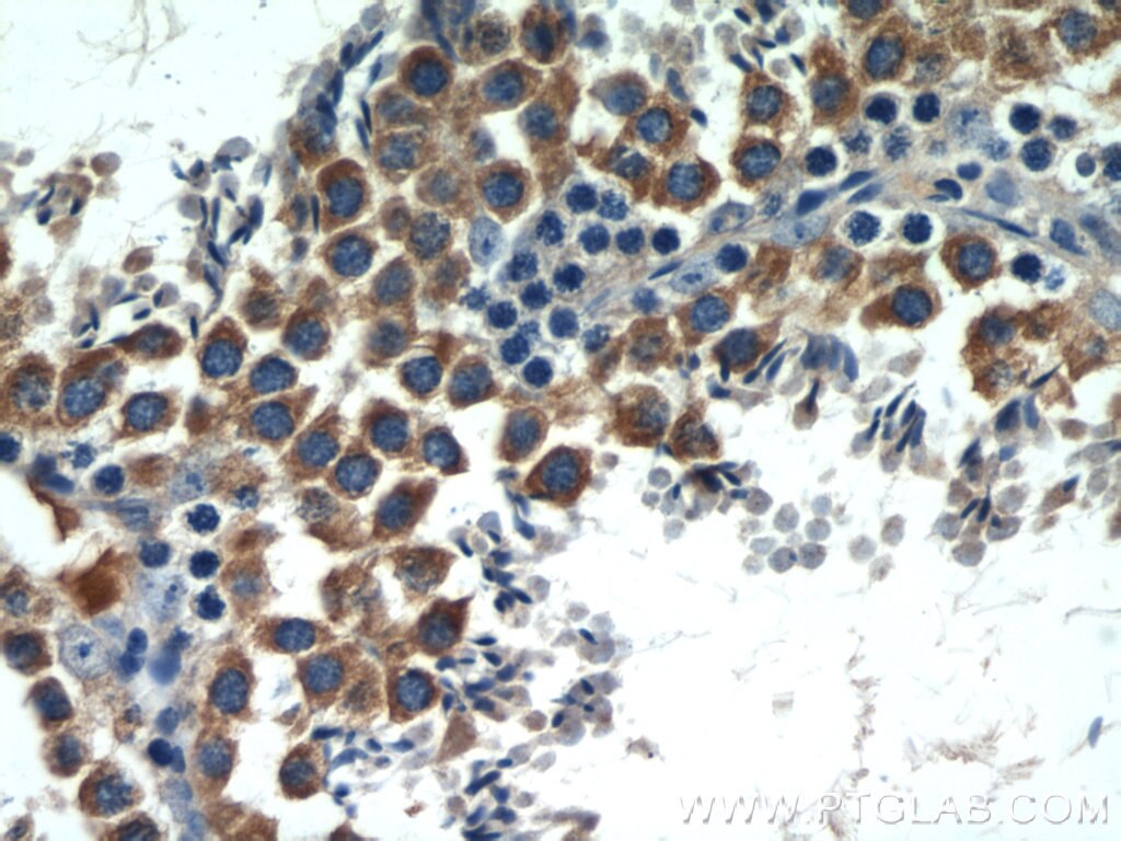IHC staining of mouse testis using 51070-2-AP