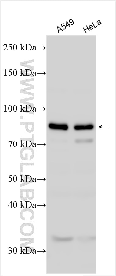 Western Blot (WB) analysis of various lysates using STAT4 Polyclonal antibody (51070-2-AP)