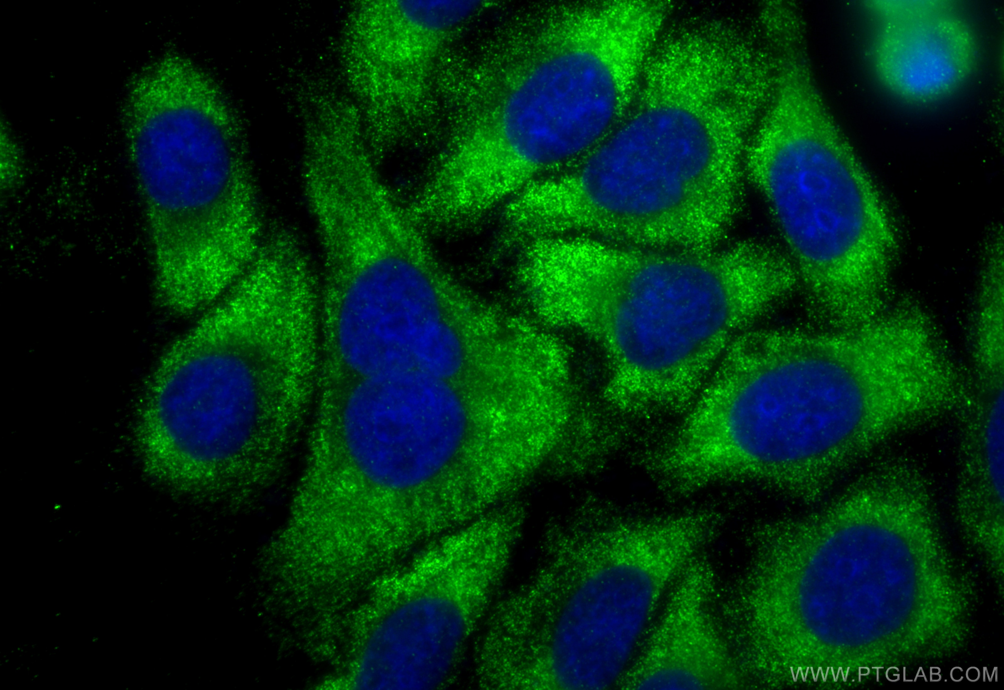 Immunofluorescence (IF) / fluorescent staining of HepG2 cells using STAT4 Monoclonal antibody (67568-2-Ig)