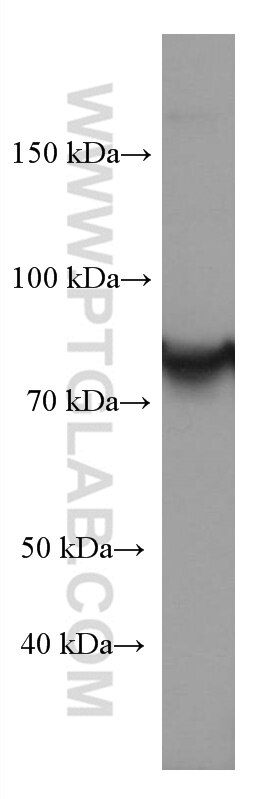 Western Blot (WB) analysis of K-562 cells using STAT4 Monoclonal antibody (67568-2-Ig)