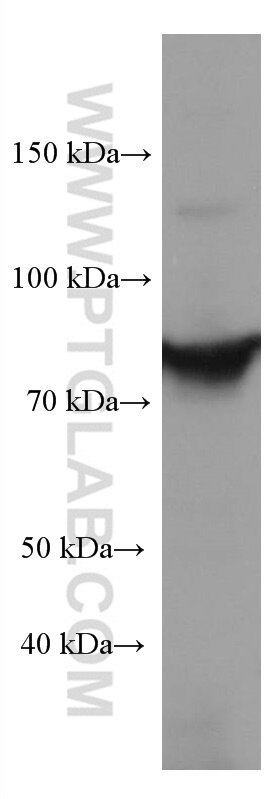 Western Blot (WB) analysis of HL-60 cells using STAT4 Monoclonal antibody (67568-2-Ig)