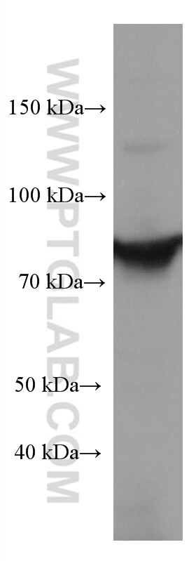 Western Blot (WB) analysis of HL-60 cells using STAT4 Monoclonal antibody (67568-2-Ig)