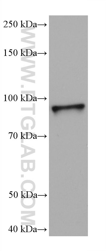 Western Blot (WB) analysis of 4T1 cells using STAT4 Monoclonal antibody (67568-2-Ig)