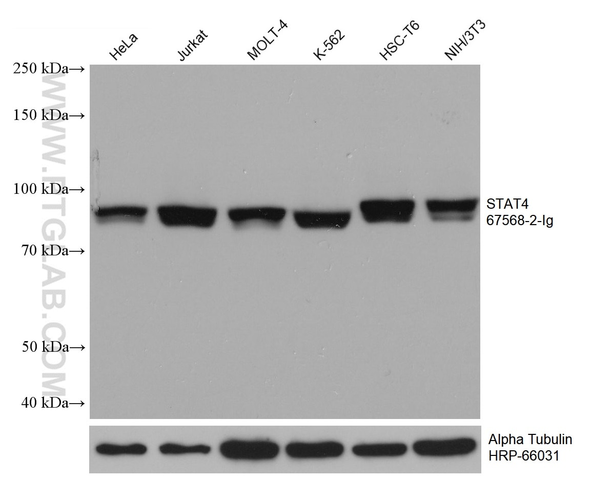 Western Blot (WB) analysis of various lysates using STAT4 Monoclonal antibody (67568-2-Ig)