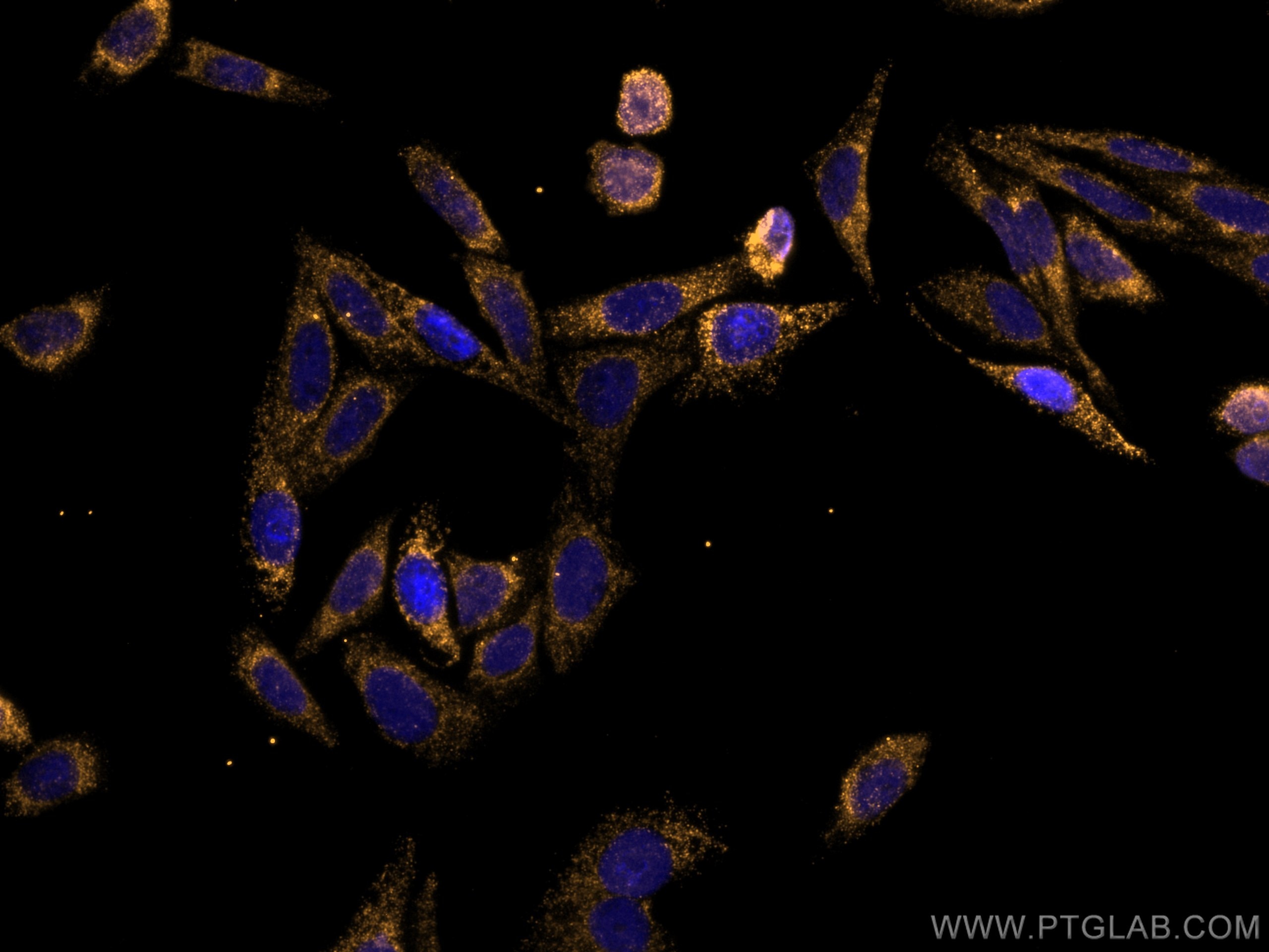Immunofluorescence (IF) / fluorescent staining of HepG2 cells using CoraLite®555-conjugated STAT4 Monoclonal antibody (CL555-67568)