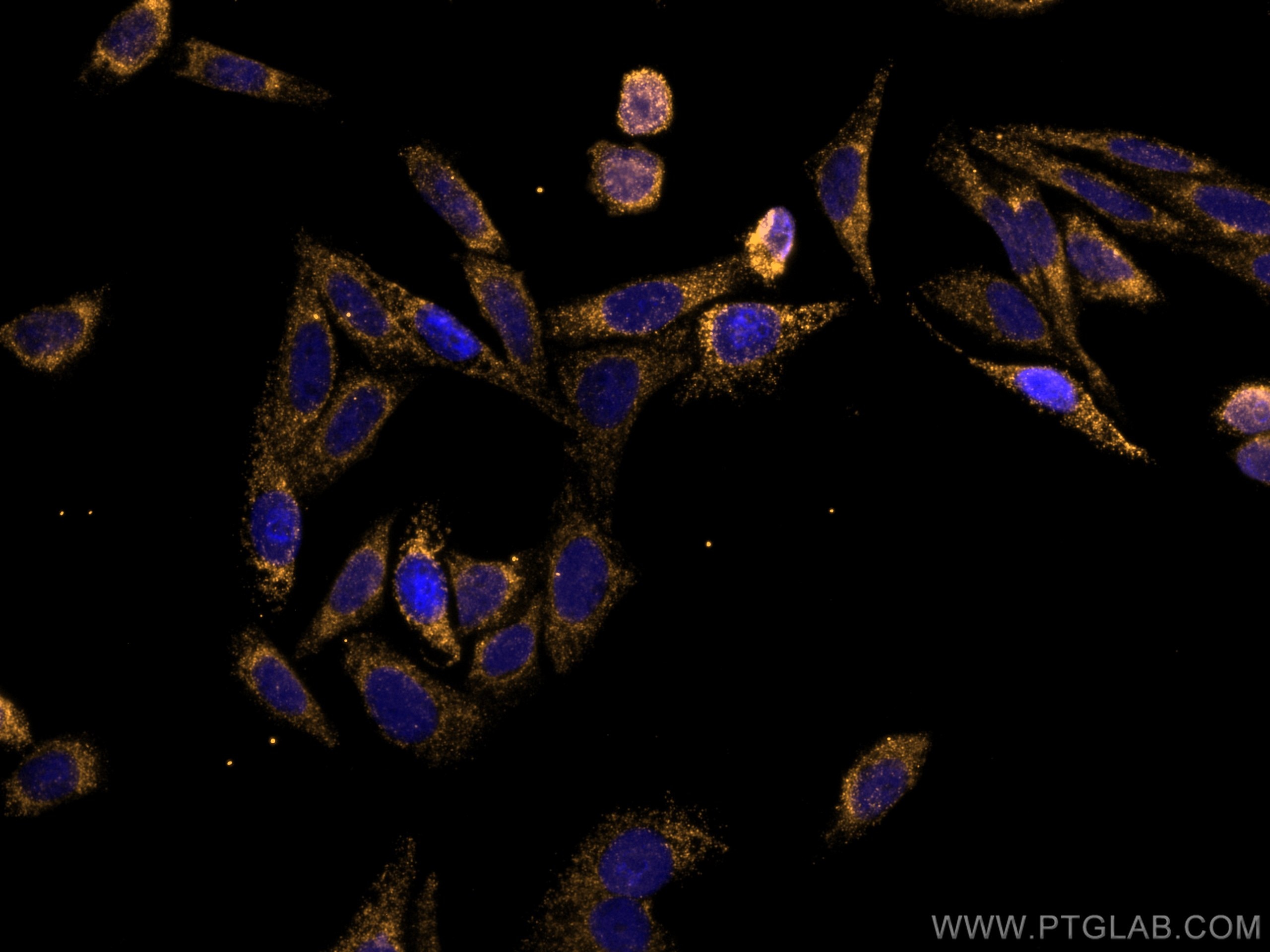 IF Staining of HepG2 using CL555-67568