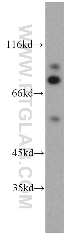 STAT5A Polyclonal antibody
