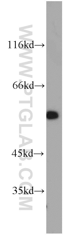 Western Blot (WB) analysis of DU 145 cells using STAT5A/B Polyclonal antibody (13179-1-AP)