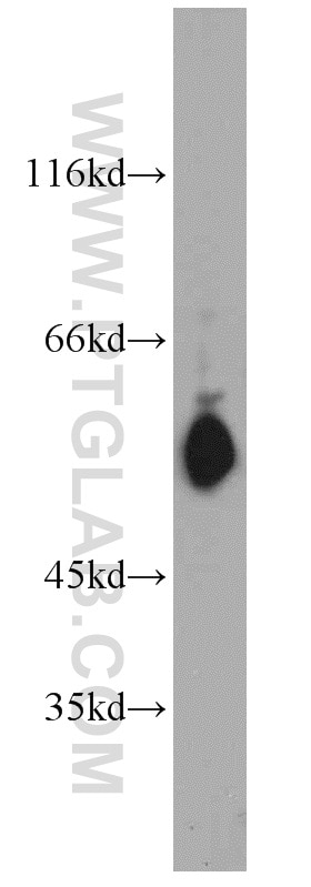 Western Blot (WB) analysis of 3T3-L1 cells using STAT5A/B Polyclonal antibody (13179-1-AP)