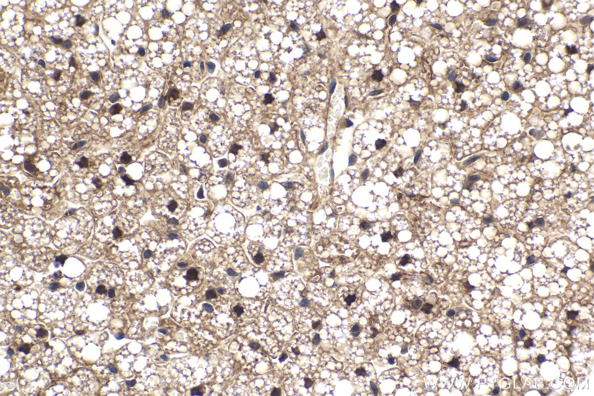 IHC staining of mouse brown adipose using 66459-1-Ig Immunohistochemistry (IHC) staining of mouse brown adipose tissue using STAT5A Monoclonal antibody (66459-1-Ig)