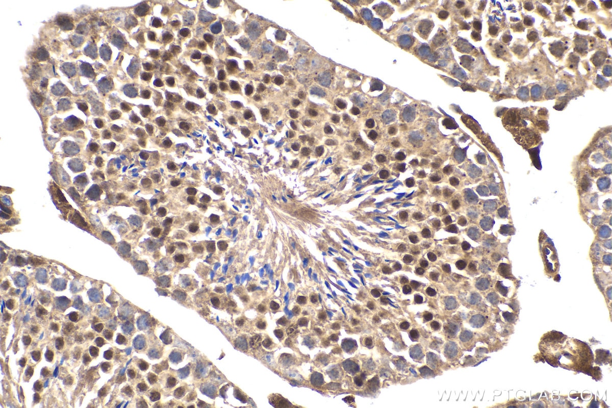 IHC staining of mouse testis using 66459-1-Ig Immunohistochemistry (IHC) staining of mouse testis tissue using STAT5A Monoclonal antibody (66459-1-Ig)