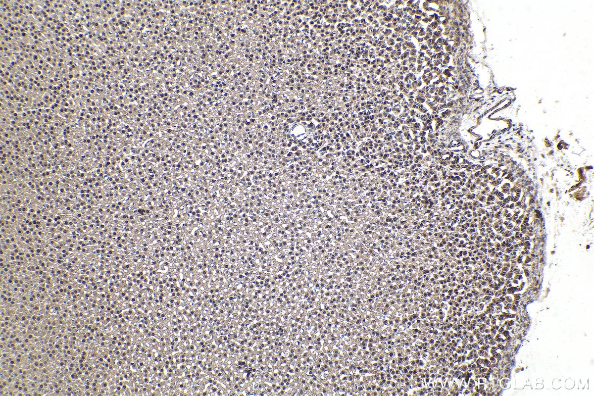 IHC staining of rat adrenal gland using 66459-1-Ig Immunohistochemistry (IHC) staining of rat adrenal gland tissue using STAT5A Monoclonal antibody (66459-1-Ig)
