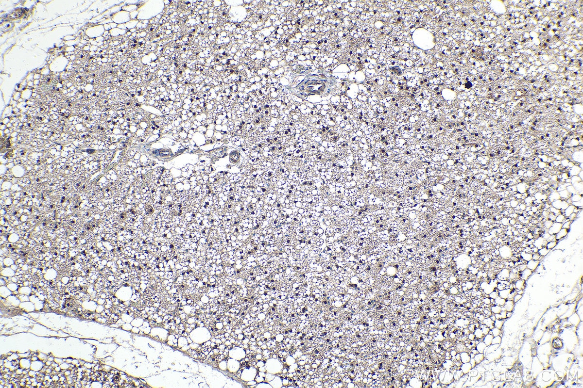 IHC staining of rat brown adipose using 66459-1-Ig Immunohistochemistry (IHC) staining of rat brown adipose tissue using STAT5A Monoclonal antibody (66459-1-Ig)