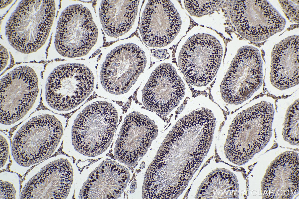 IHC staining of rat testis using 66459-1-Ig Immunohistochemistry (IHC) staining of rat testis tissue using STAT5A Monoclonal antibody (66459-1-Ig)