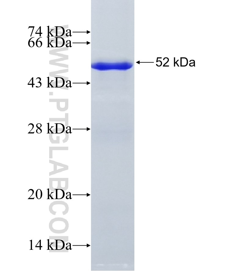 STAT5A fusion protein Ag19546 SDS-PAGE