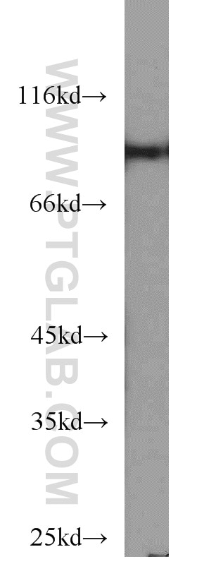 STAT5A/B Polyclonal antibody