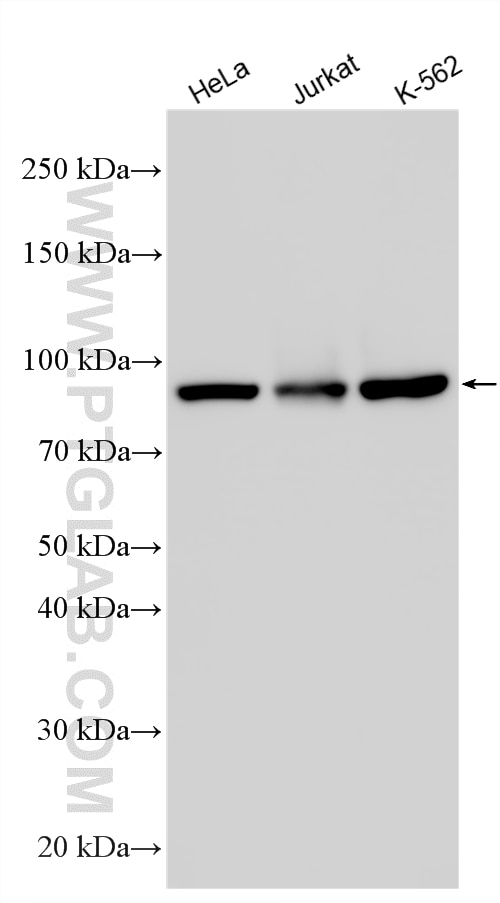 Various lysates were subjected to SDS PAGE followed by western blot with 51072-2-AP (STAT5B-Specific antibody) at dilution of 1:3000 incubated at room temperature for 1.5 hours. Western Blot (WB) analysis of various lysates using STAT5B-Specific Polyclonal antibody (51072-2-AP)