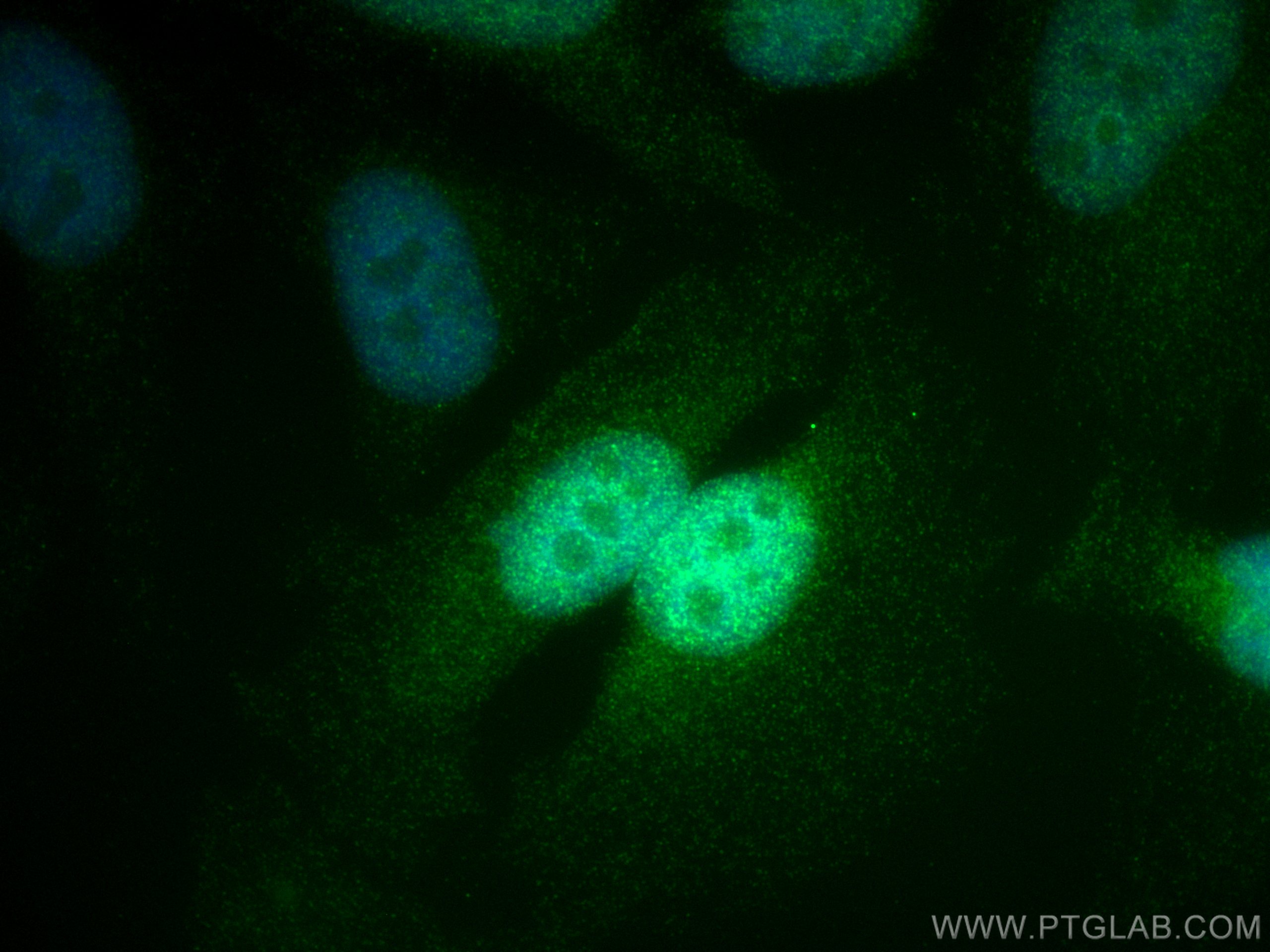 Immunofluorescence (IF) / fluorescent staining of HeLa cells using STAT5B Monoclonal antibody (66427-1-Ig)