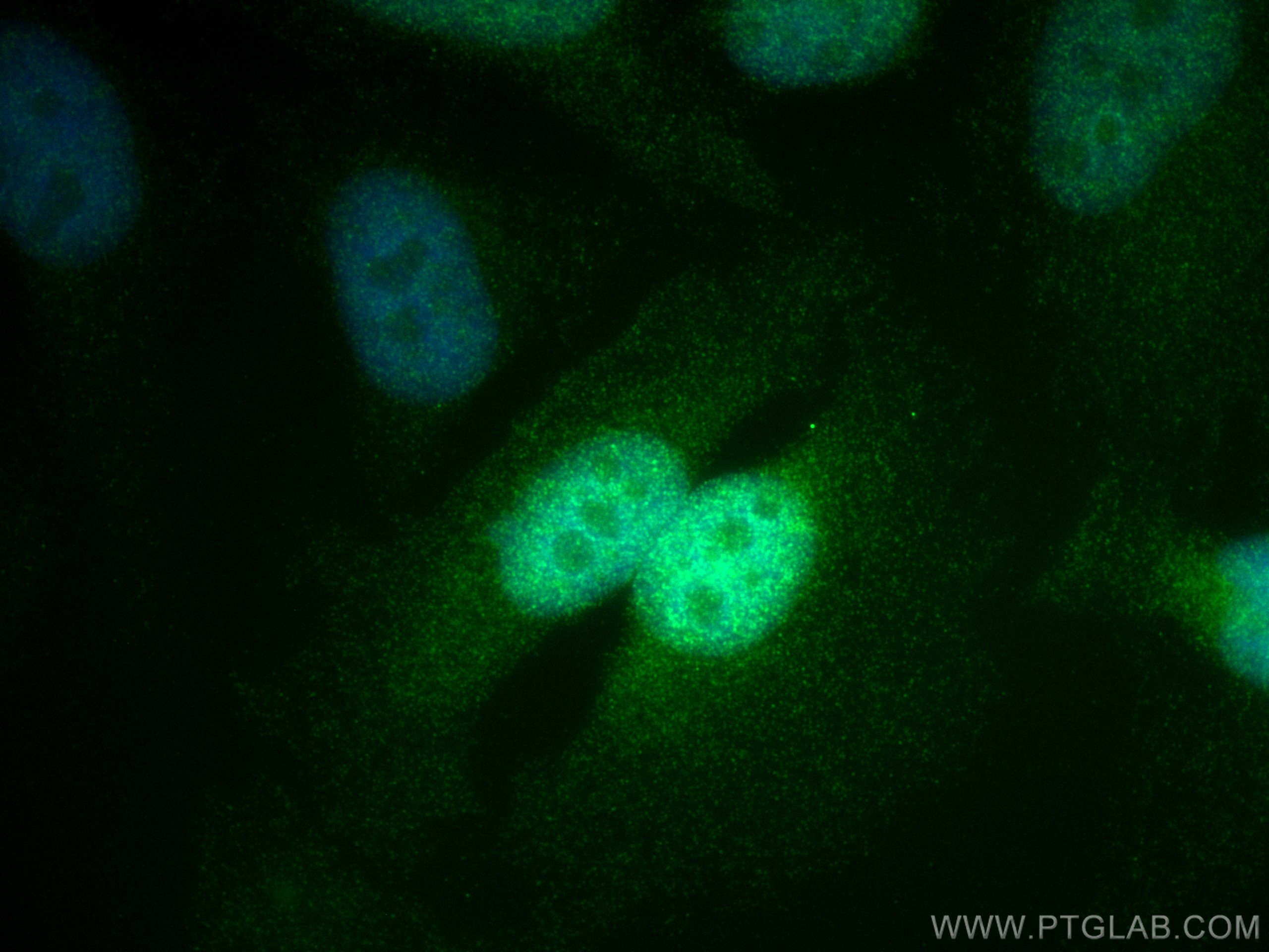 IF Staining of HeLa using 66427-1-Ig