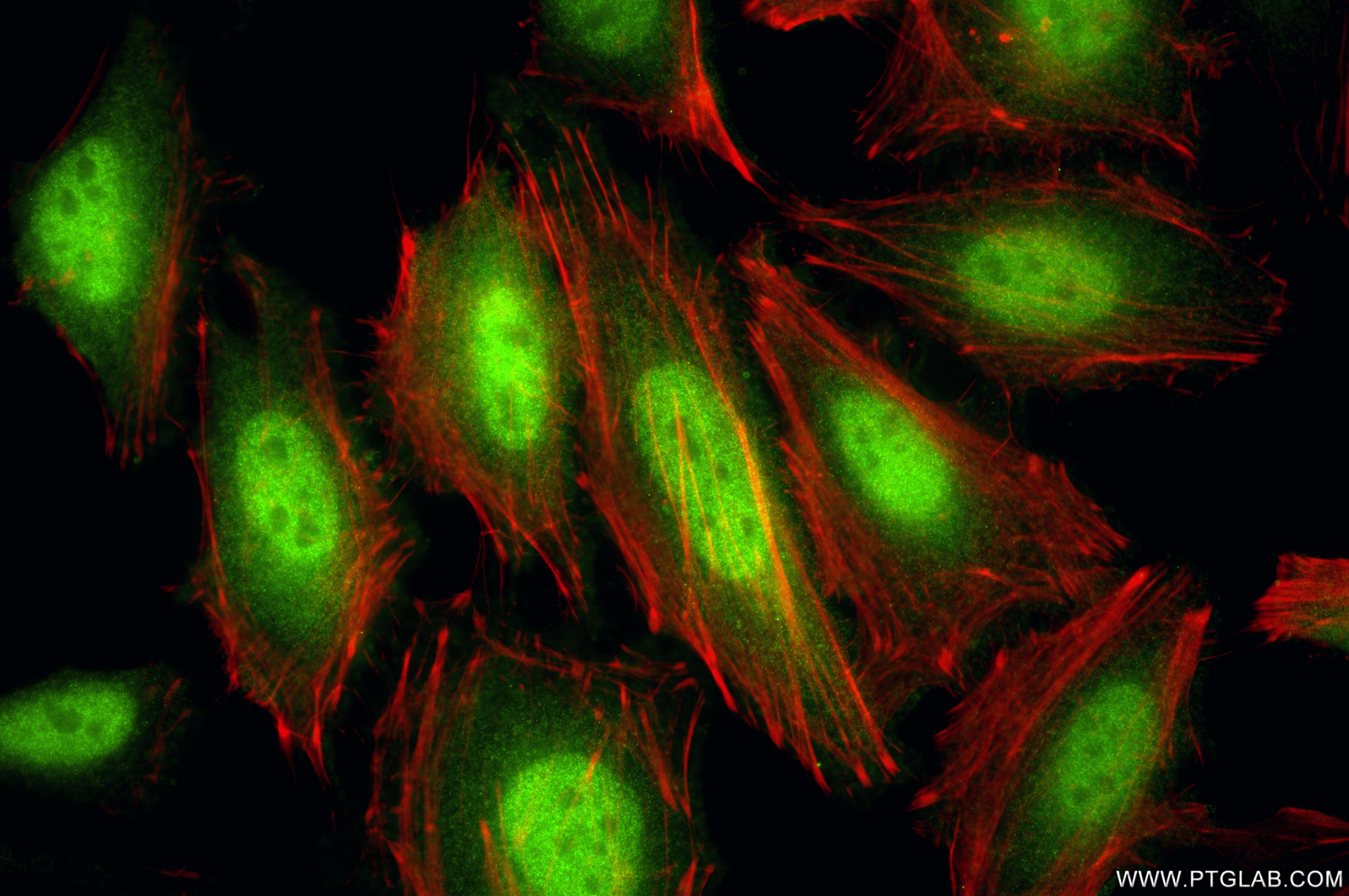 IF Staining of HeLa using 87224-2-RR (same clone as 87224-2-PBS) Immunofluorescence (IF) / fluorescent staining of HeLa cells using STAT5B Recombinant monoclonal antibody (87224-2-RR)
