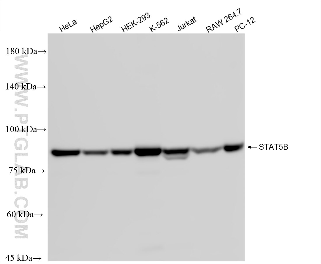 WB analysis using 87224-2-RR (same clone as 87224-2-PBS) Western Blot (WB) analysis of various lysates using STAT5B Recombinant monoclonal antibody (87224-2-RR)
