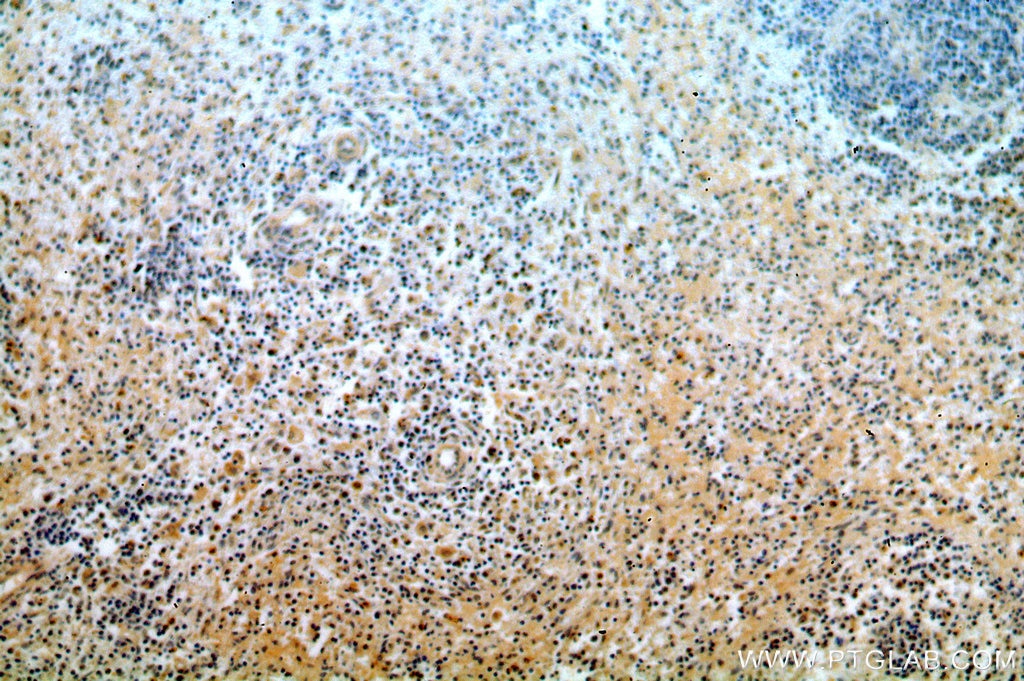 Immunohistochemistry (IHC) staining of human spleen tissue using STAT6 70kDa Polyclonal antibody (10257-1-AP)