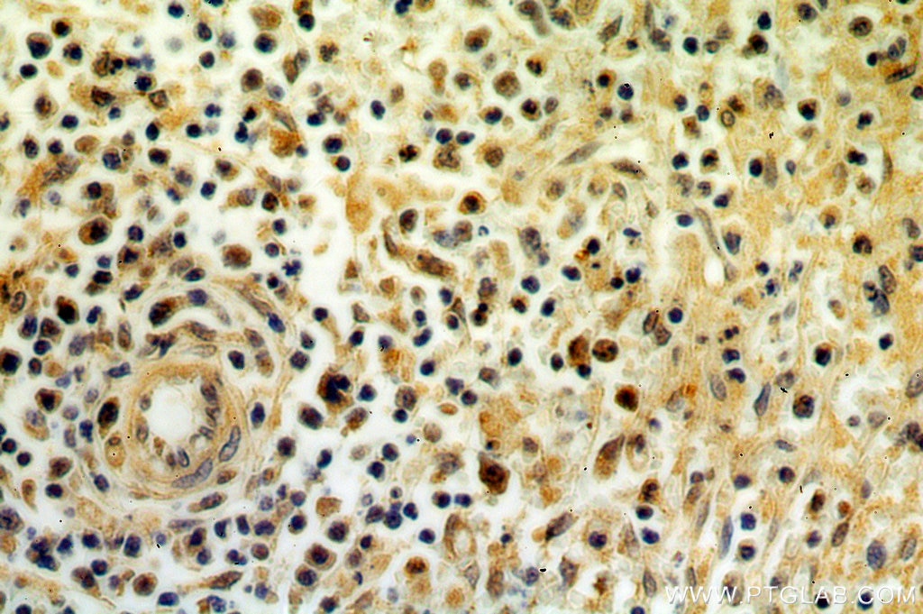 Immunohistochemistry (IHC) staining of human spleen tissue using STAT6 70kDa Polyclonal antibody (10257-1-AP)