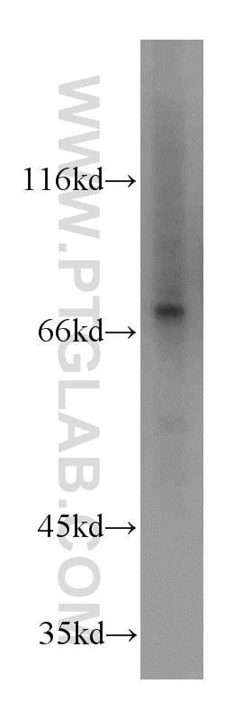 Western Blot (WB) analysis of HeLa cells using STAT6 70kDa Polyclonal antibody (10257-1-AP)