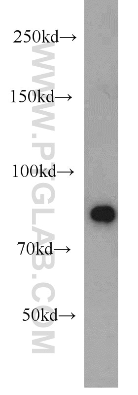 Western Blot (WB) analysis of HeLa cells using STAT6 70kDa Polyclonal antibody (10257-1-AP)