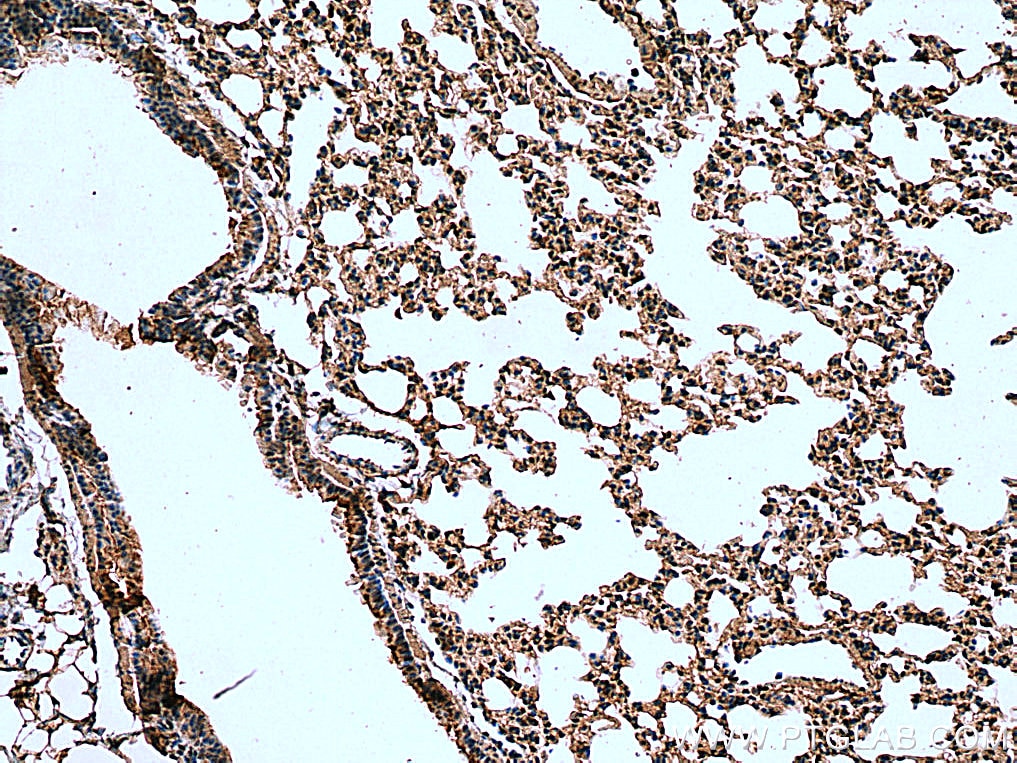 IHC staining of mouse lung using 51073-1-AP