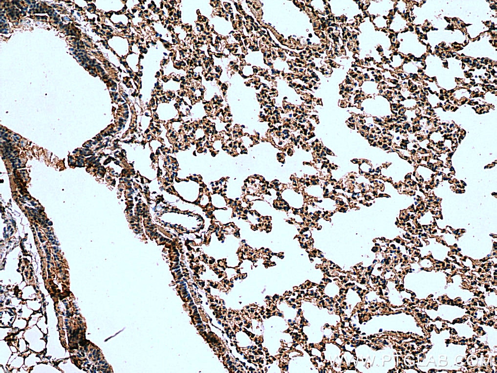 Immunohistochemistry (IHC) staining of mouse lung tissue using STAT6 Polyclonal antibody (51073-1-AP)