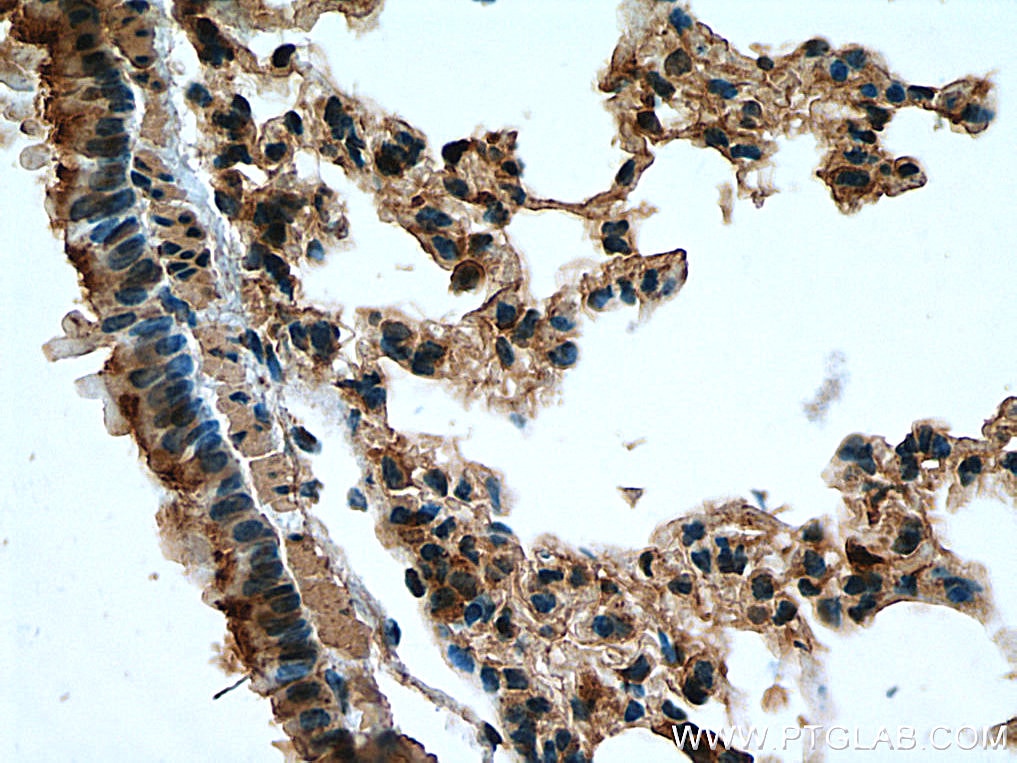 IHC staining of mouse lung using 51073-1-AP