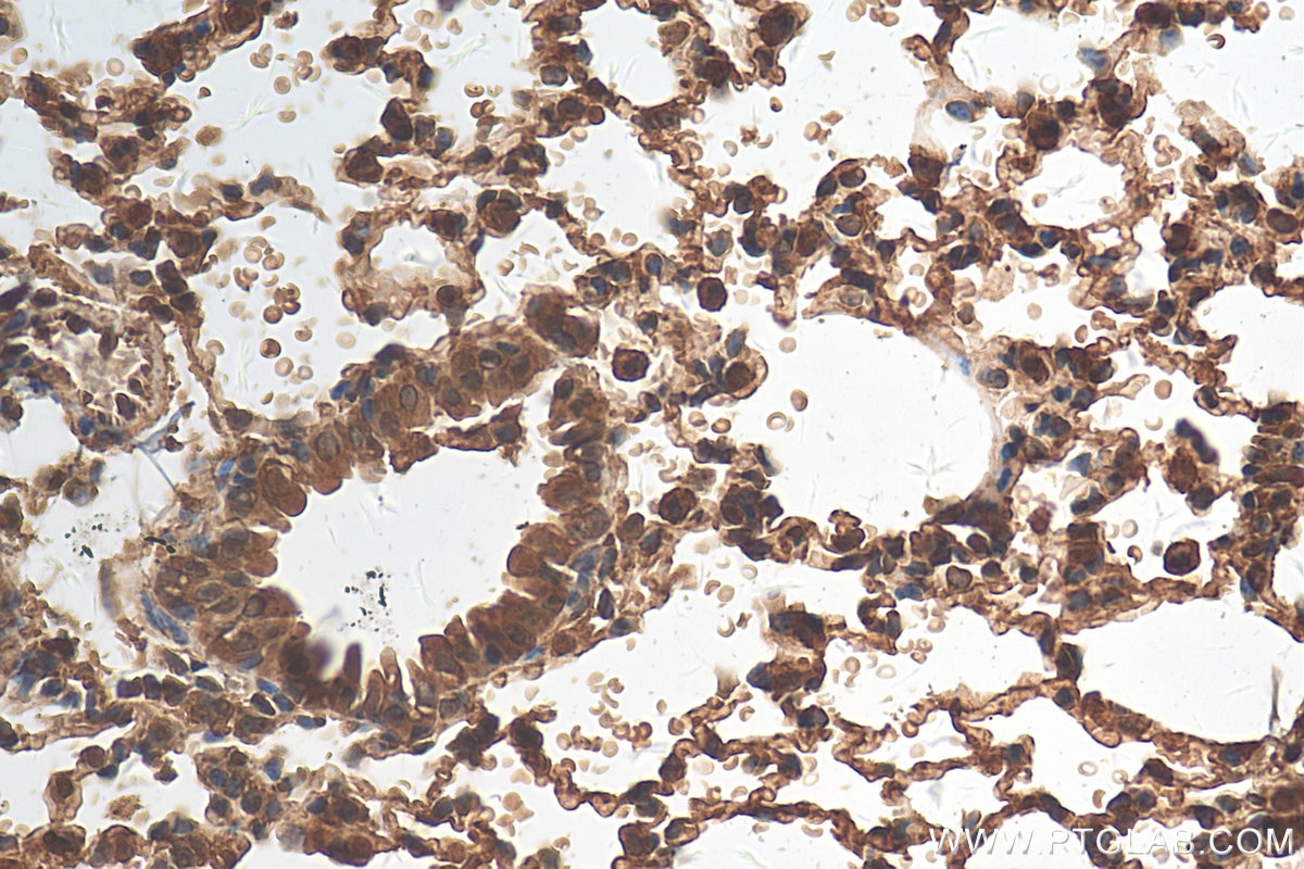 Immunohistochemistry (IHC) staining of mouse lung tissue using STAT6 Polyclonal antibody (51073-1-AP)