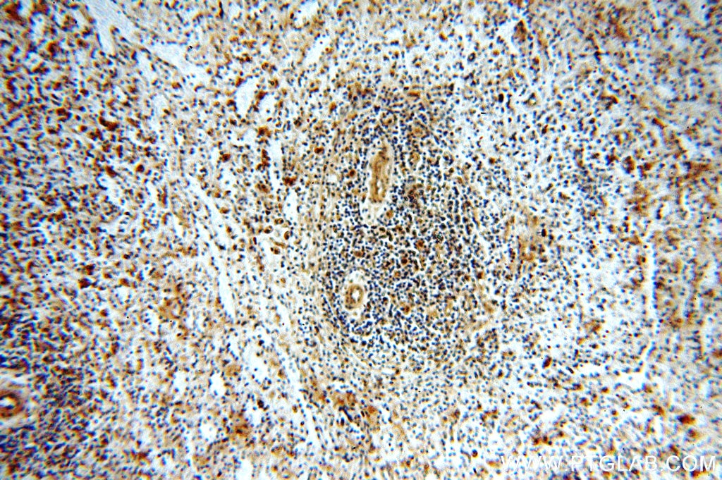 Immunohistochemistry (IHC) staining of human spleen tissue using STAT6 Polyclonal antibody (51073-1-AP)