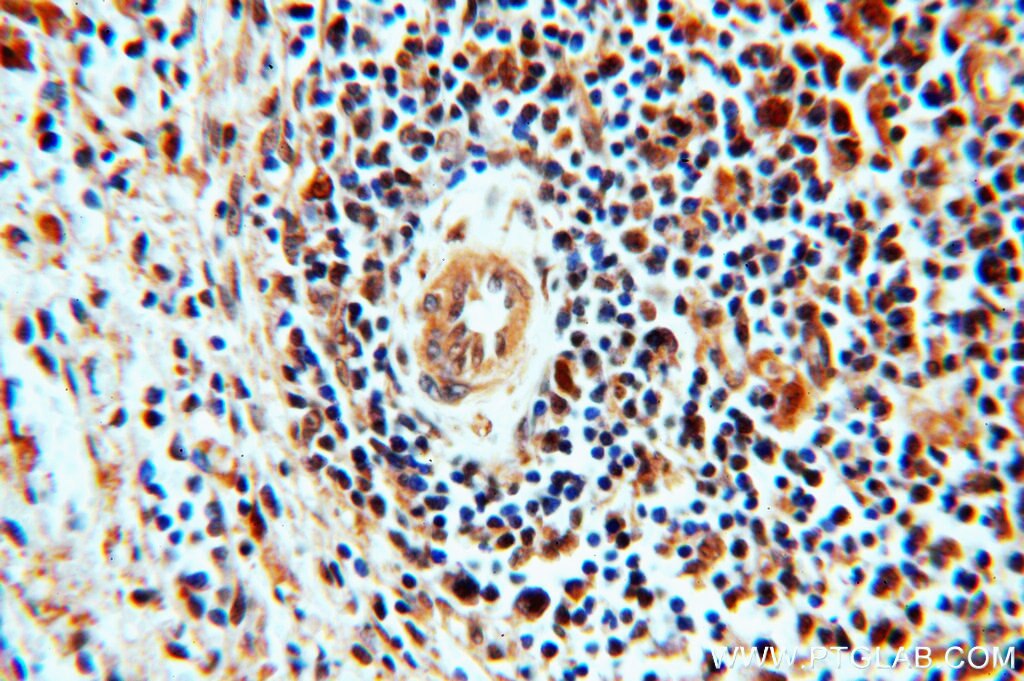 Immunohistochemistry (IHC) staining of human spleen tissue using STAT6 Polyclonal antibody (51073-1-AP)