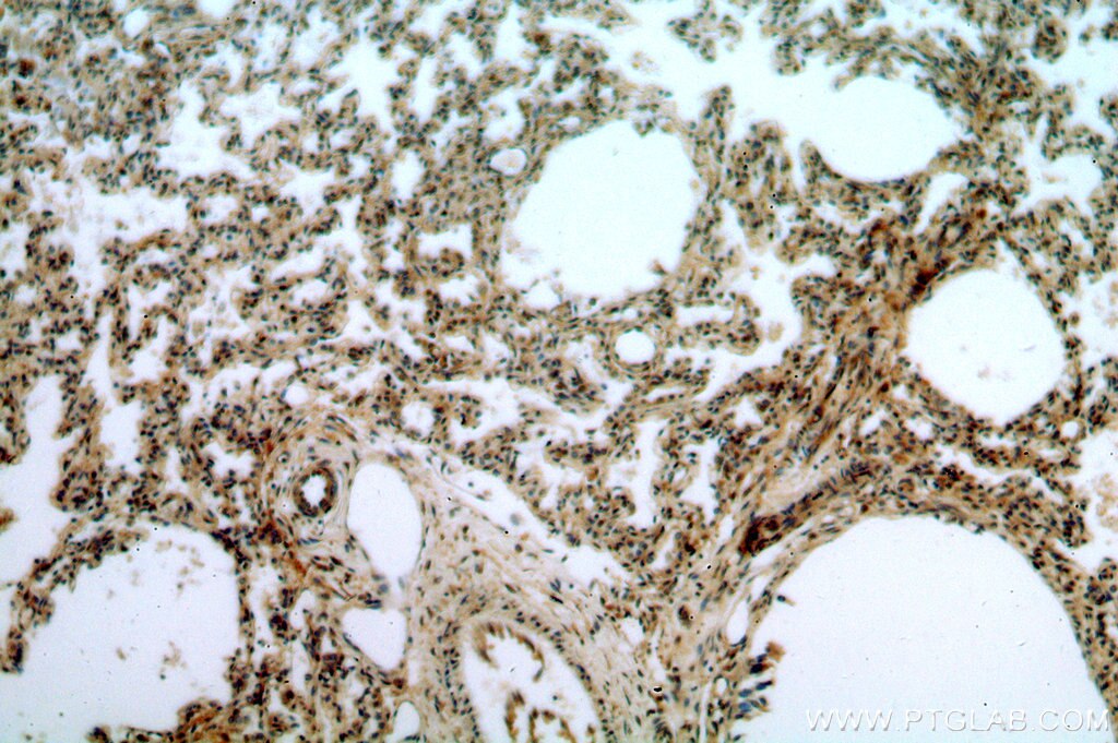 IHC staining of human lung using 51073-1-AP