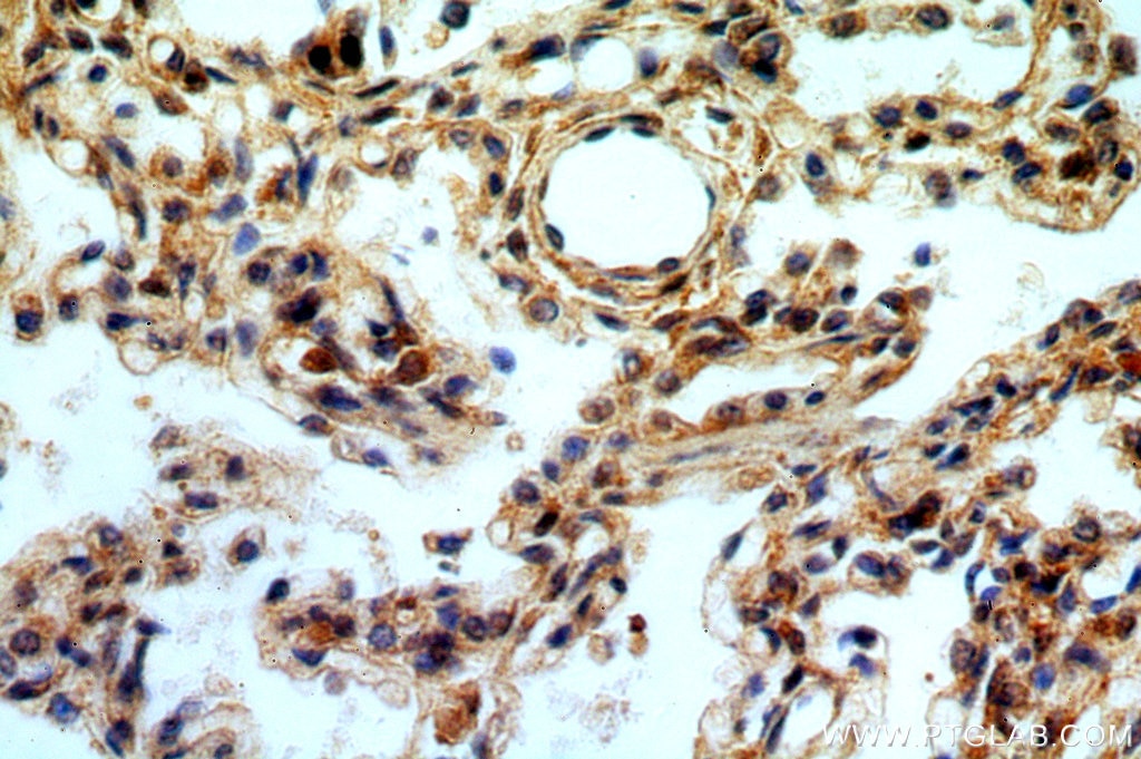 Immunohistochemistry (IHC) staining of human lung tissue using STAT6 Polyclonal antibody (51073-1-AP)