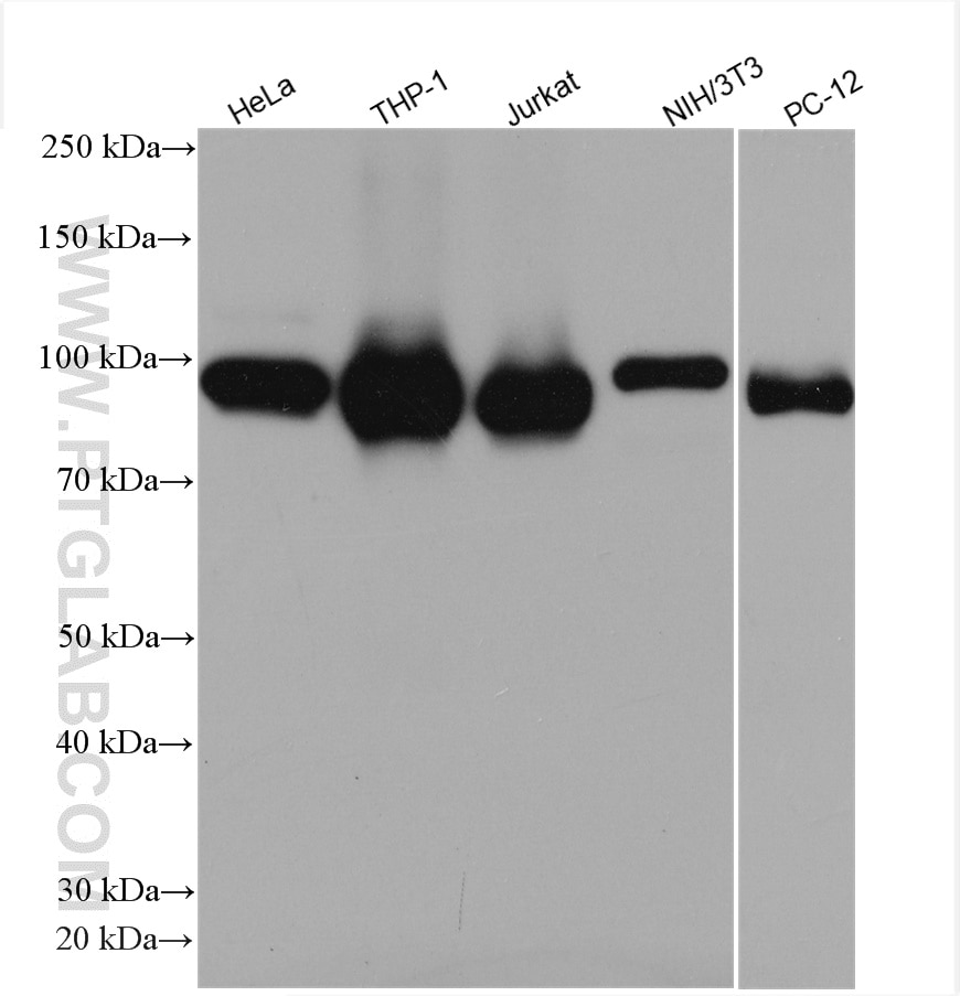 Western Blot (WB) analysis of various lysates using STAT6 Polyclonal antibody (51073-1-AP)