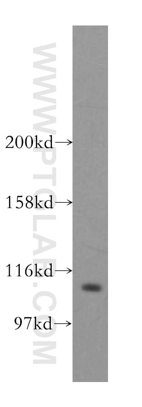 Western Blot (WB) analysis of MCF-7 cells using STAT6 Polyclonal antibody (51073-1-AP)