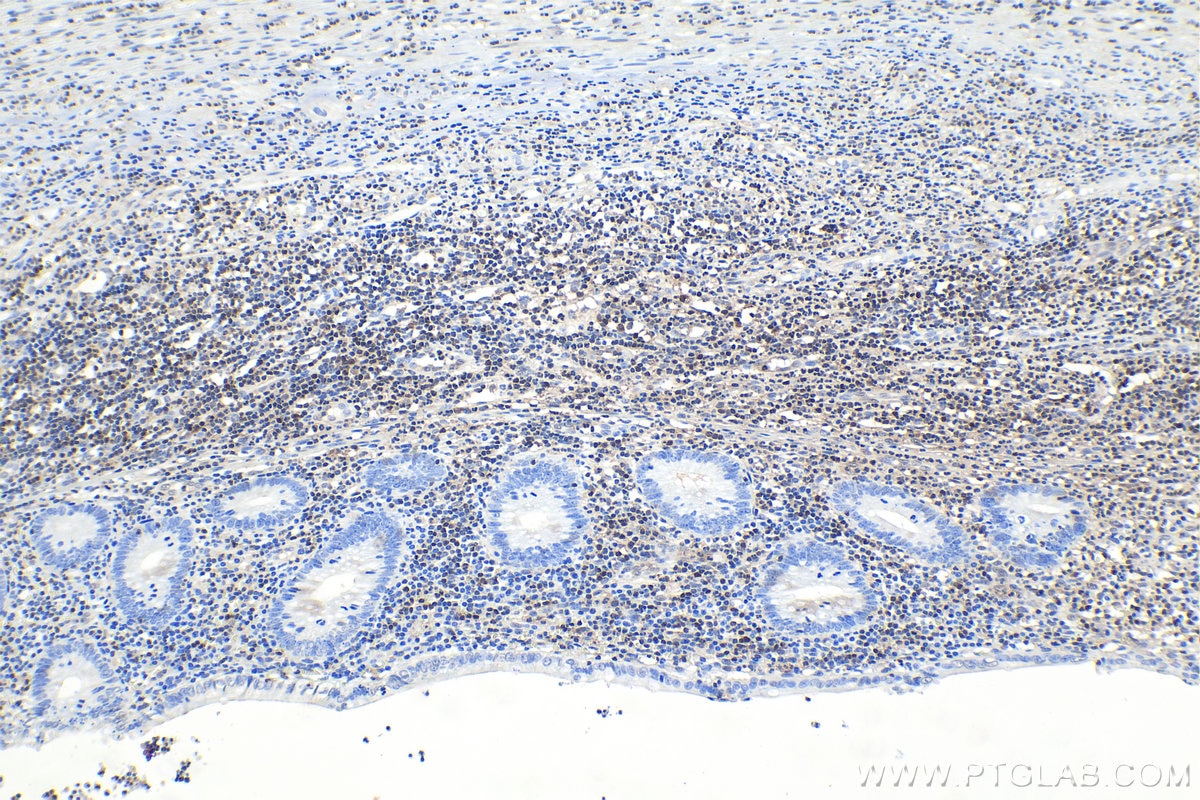 Immunohistochemistry (IHC) staining of human appendicitis tissue using STAT6 Monoclonal antibody (66717-1-Ig)